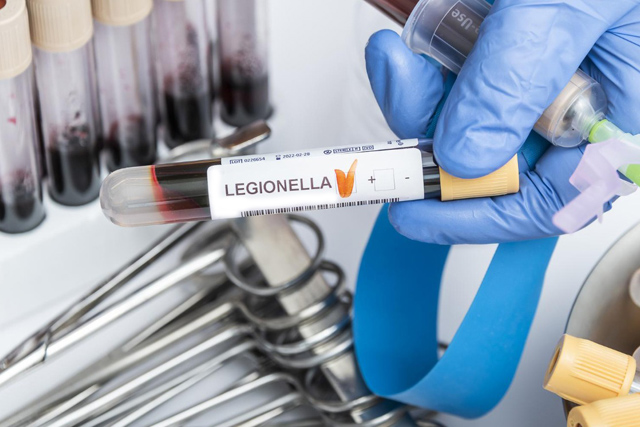 la-legionella-sintomas-y-tratamientos